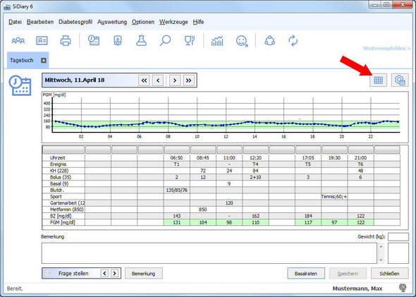 SiDiary mit FGM Verlaufskurve des aktuellen Tages
